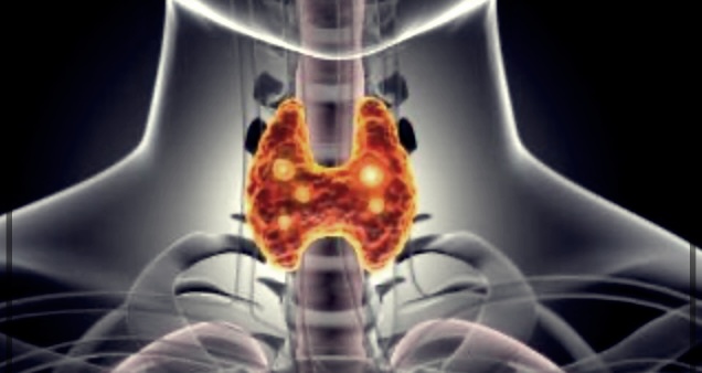 갑상선 부음의 원인과 치료법