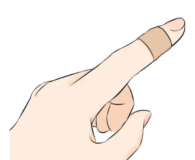테이핑 방법