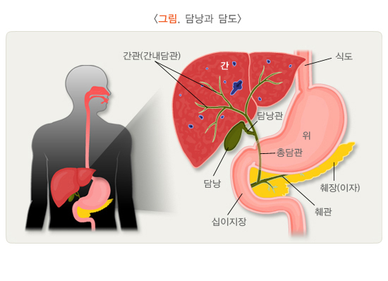 담석
