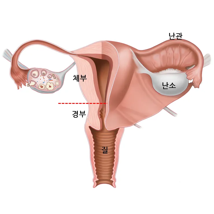 출산 후 자궁수축 기간_3