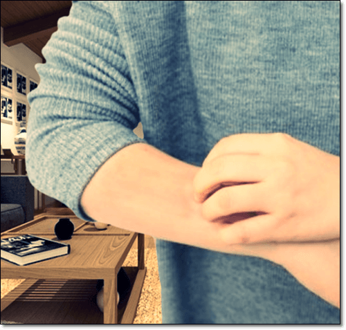 피부염으로 가려운 환자