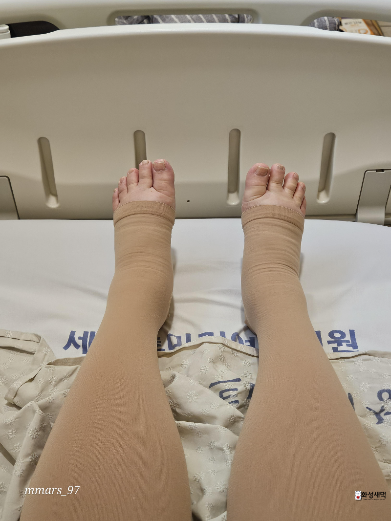 수원세인트마리-제왕절개