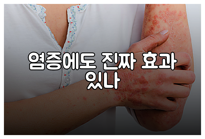 염증에도 진짜 효과 있나
