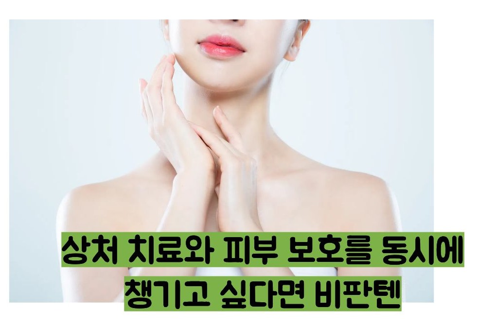 비판텐 연고 효능