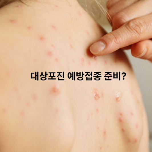 병원별 대상포진 예방접종 가격 차이
