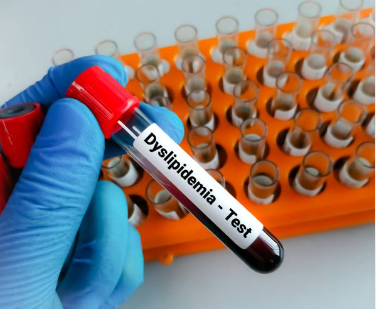 이상지질혈증의 원인과 증상, 진단, 치료와 예방 방법, 합병증