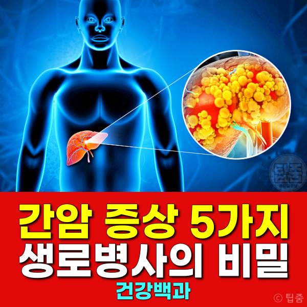 간암 증상 생로병사의비밀