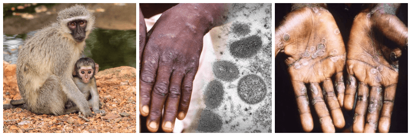 원숭이, 원숭이두창, 포진 사진