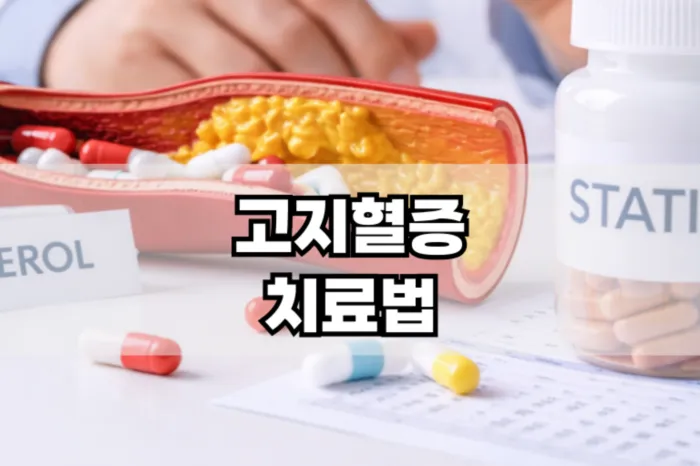 고지혈증 치료법