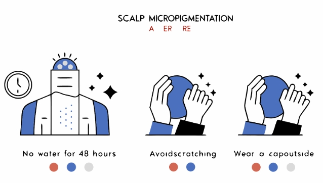 두피문신하는 전과정