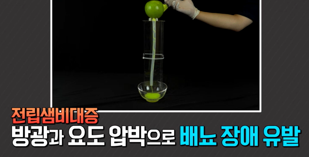 전립선 비대증에 좋은 사군자