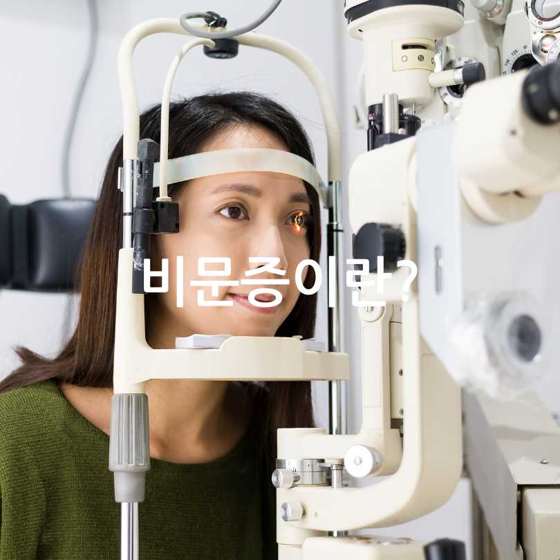 비문증(날파리증)