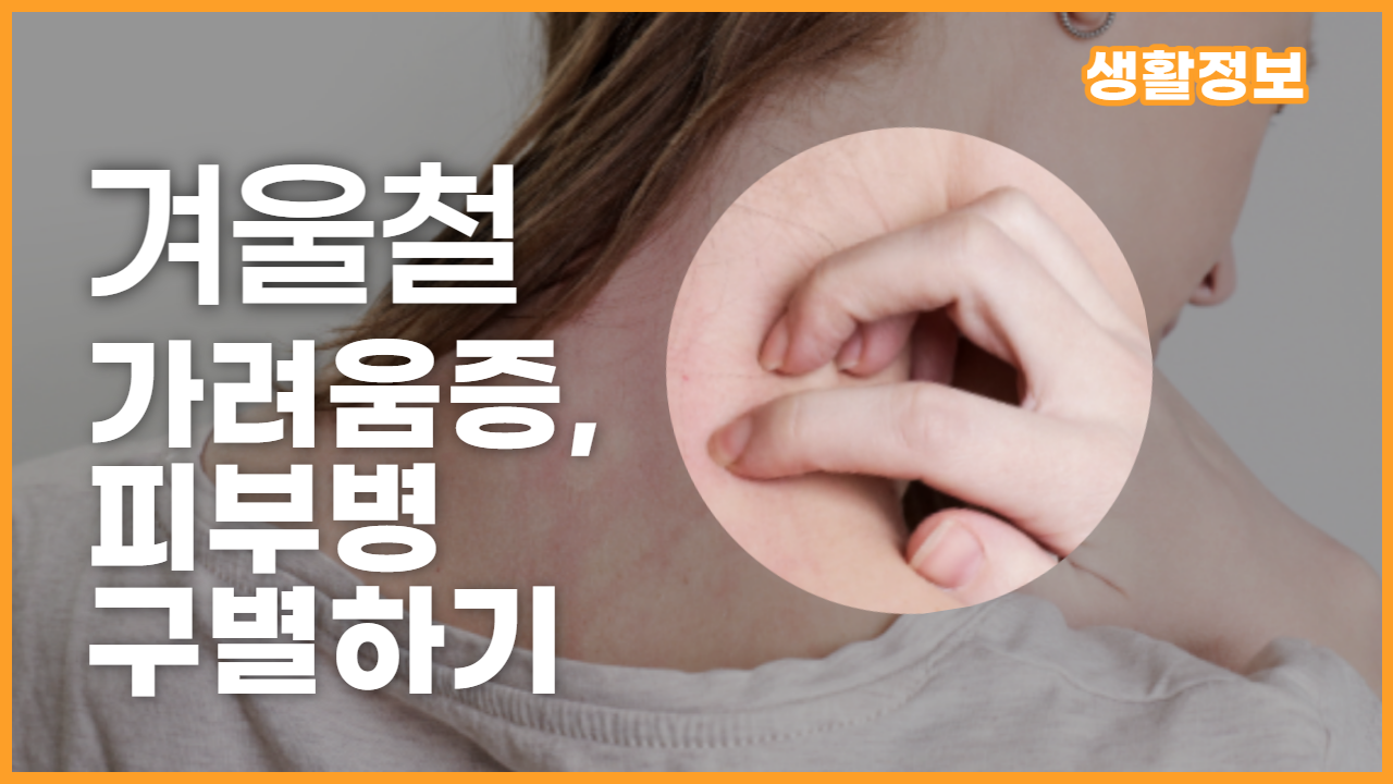 건조한 겨울철, 피부 건강을 지키기 위한 실용적인 조언과 피부병 대처 방법을 제공합니다.