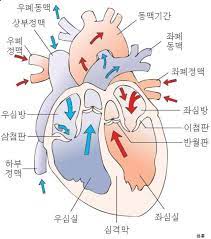 심근경색증