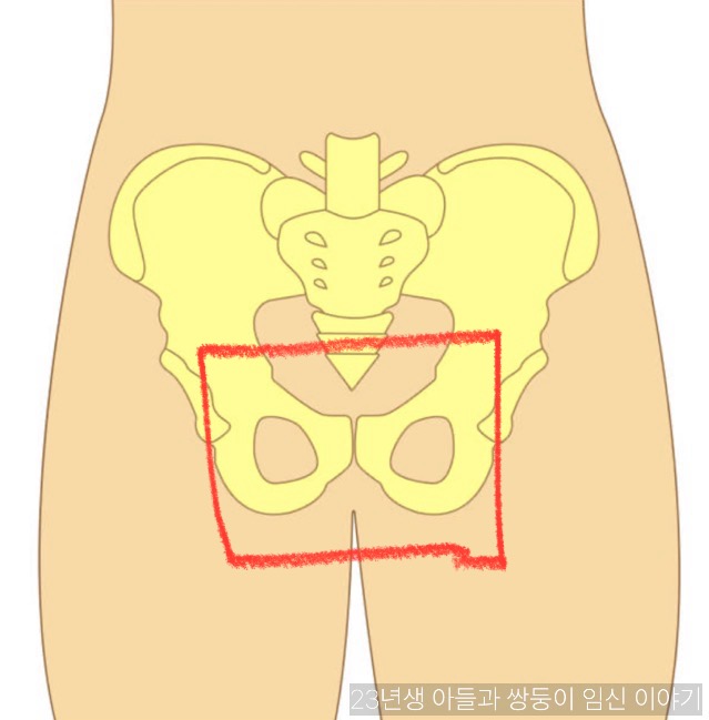 쌍둥이 임신 21~24주 증상 리얼 후기
