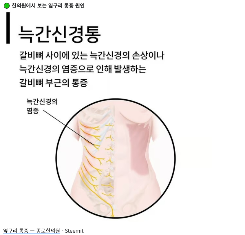 왼쪽 오른쪽 옆구리 통증 원인 5가지와 찌릿한 증상별 대처법 총정리