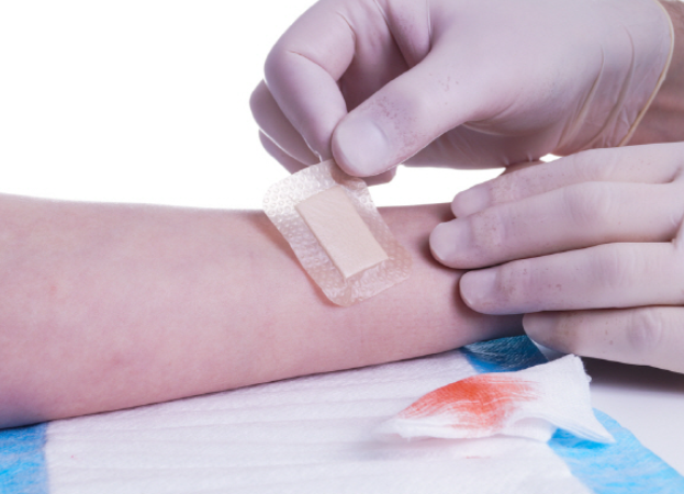 화상 치료 가이드