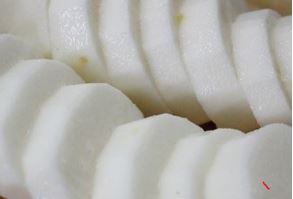 스트레스성위염