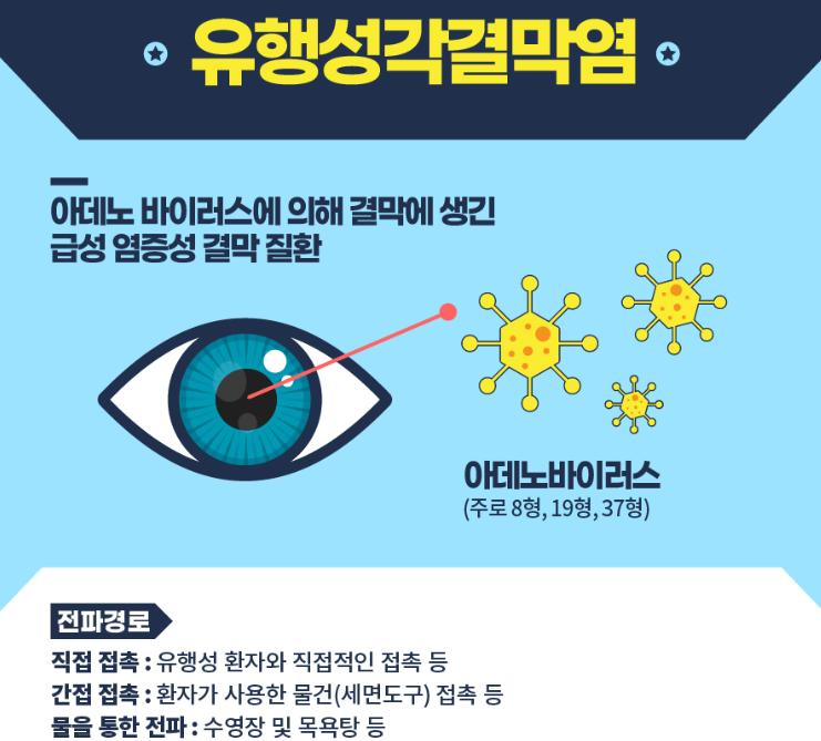 유행성 결막염