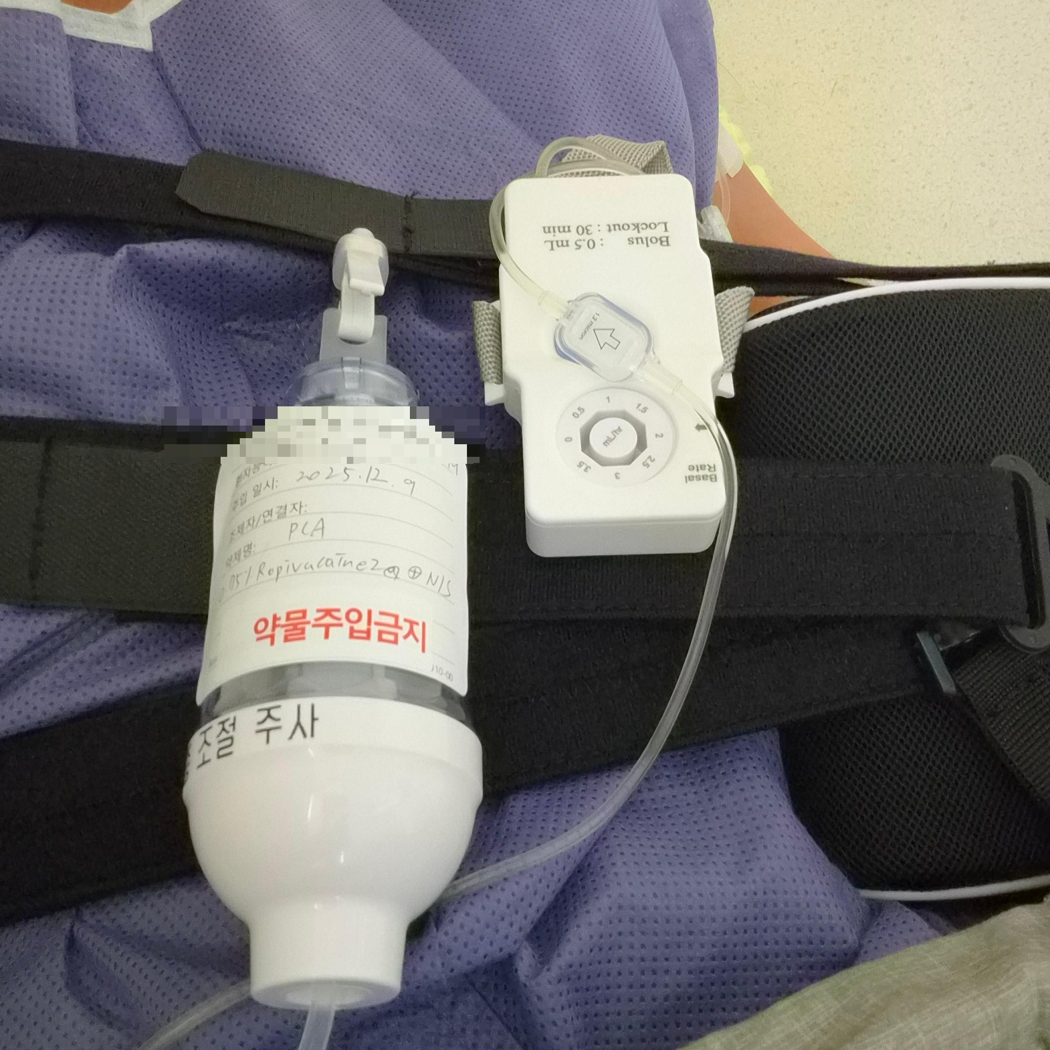 어깨 와순파열 수술 혼자 입원해서 수술까지 과정 정리 