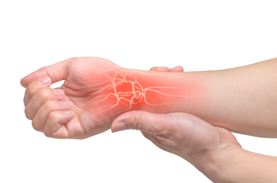 손목터널증후군