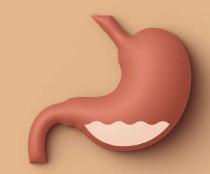 역류성 식도염에 좋은 음식 나쁜 음식 총정리