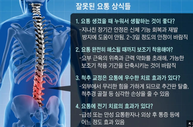 허리 아프면 무조건 누워있어야 한다고?...천만에