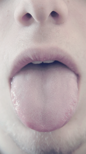 구내염 빨리 낫는법