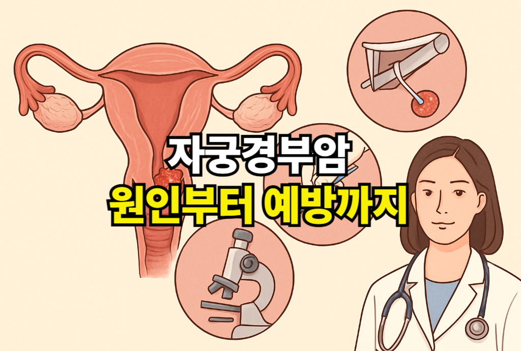 자궁경부암