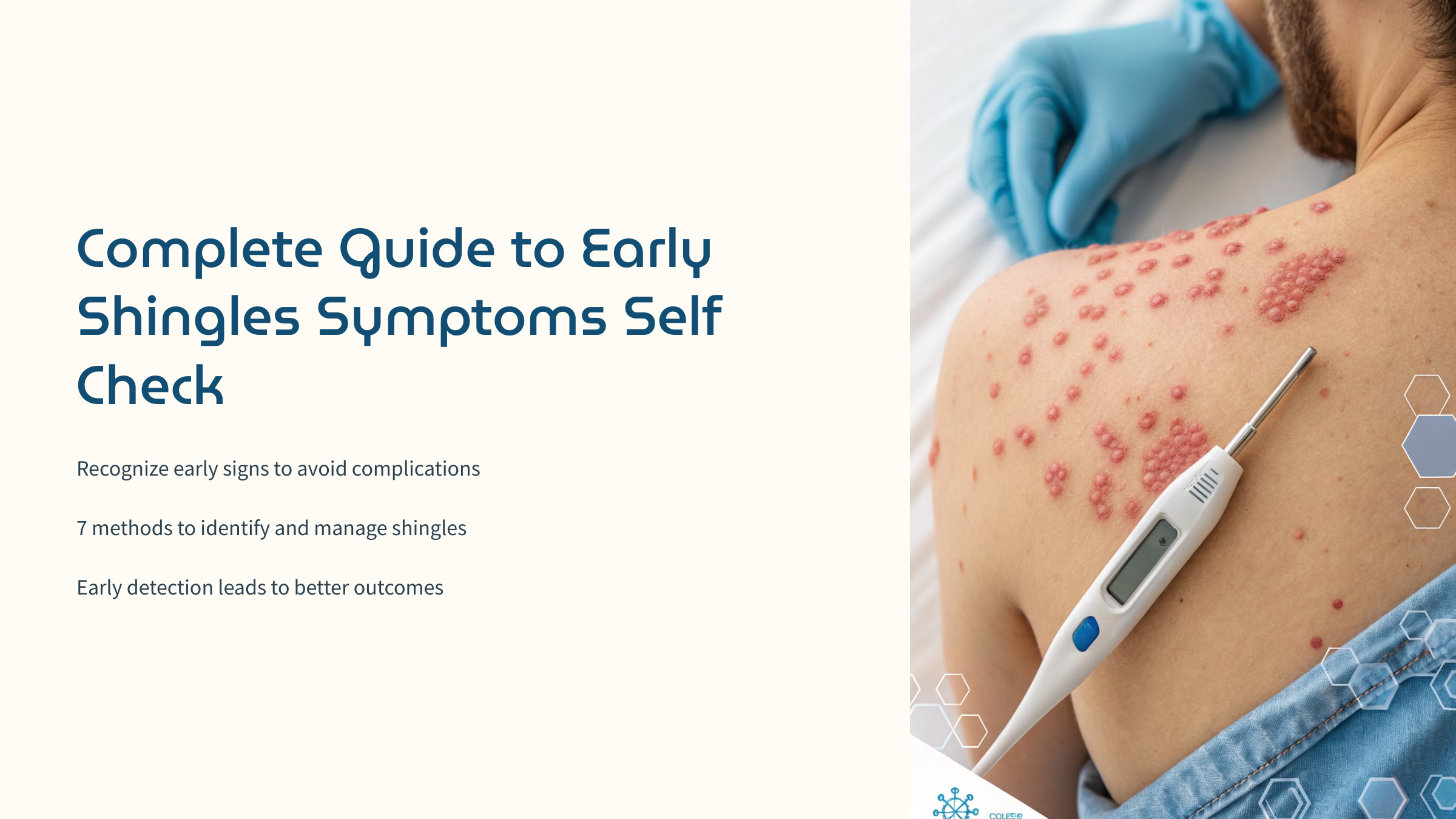 close-up of shingles rash on skin with medical thermometer nearby, soft clinical lighting, educational medical photography style