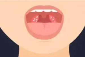 입냄새-제거방법