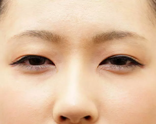 눈밑 꺼짐 없애는방법