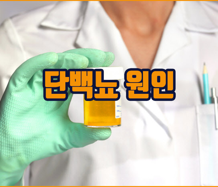 단백뇨 원인 - 신장질환, 당뇨병, 고혈압, 임신 등