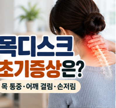 목을 짚고 통증을 느끼는 여성과 목디스크 초기증상 안내
