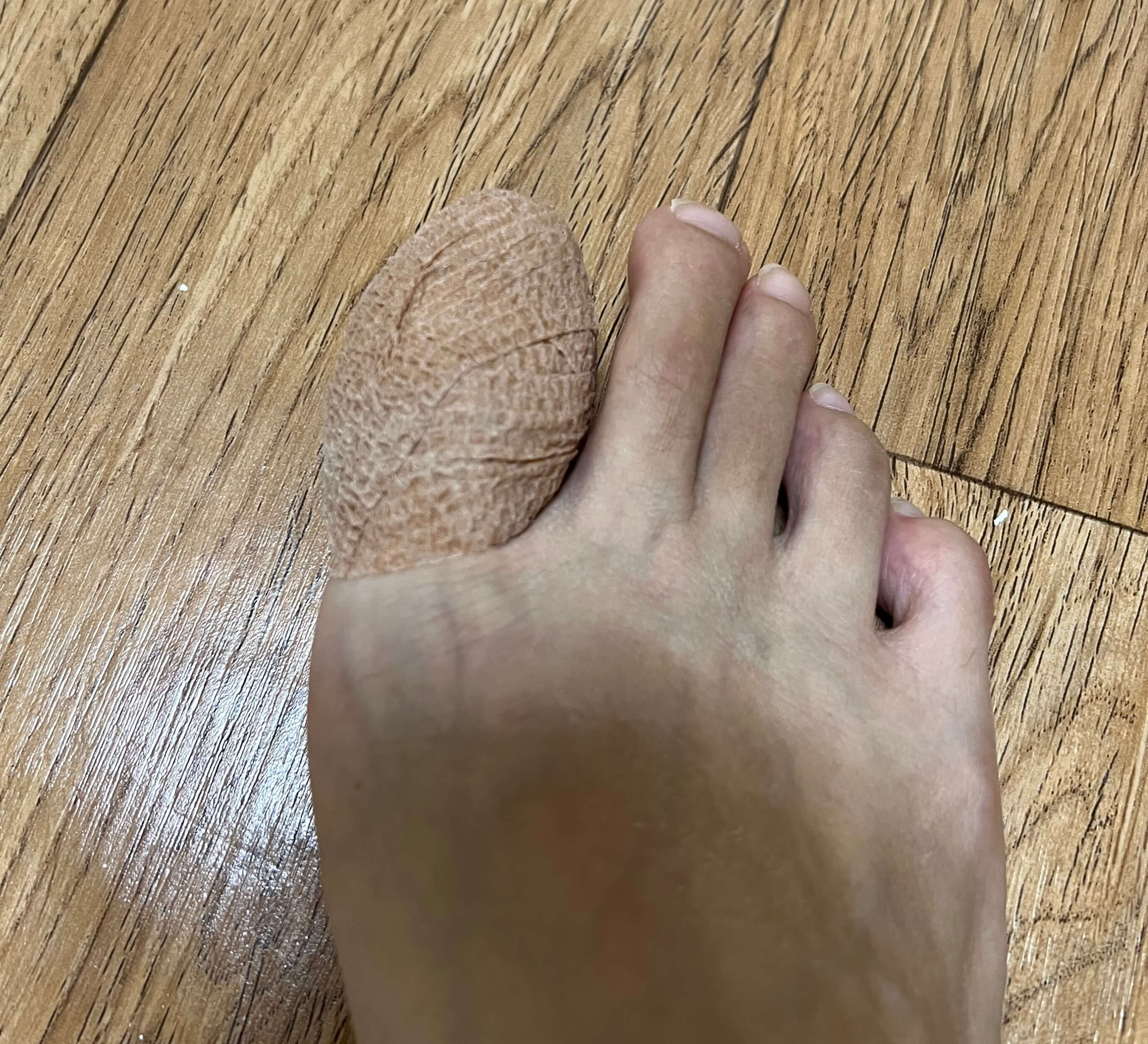 발가락