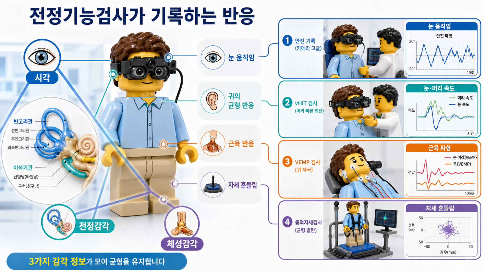 전정기능검사에서 시각·전정감각·체성감각과 안진·vHIT·VEMP·동적자세검사 반응을 비교하는 인포그래픽
