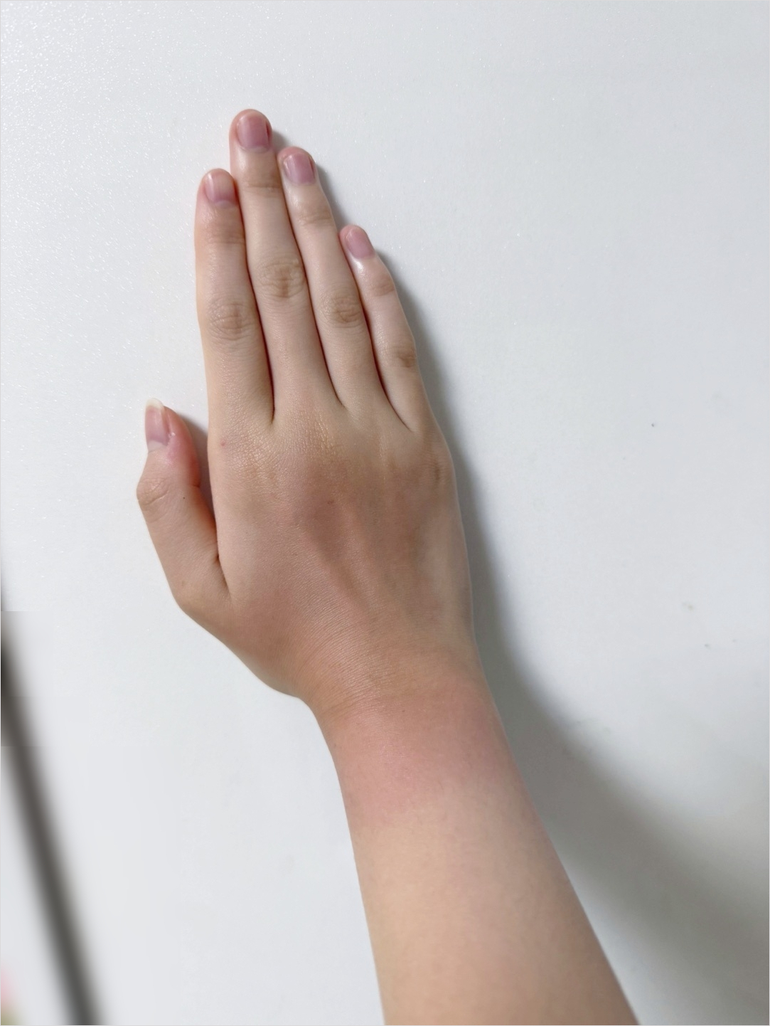 피부 탔을때 복구