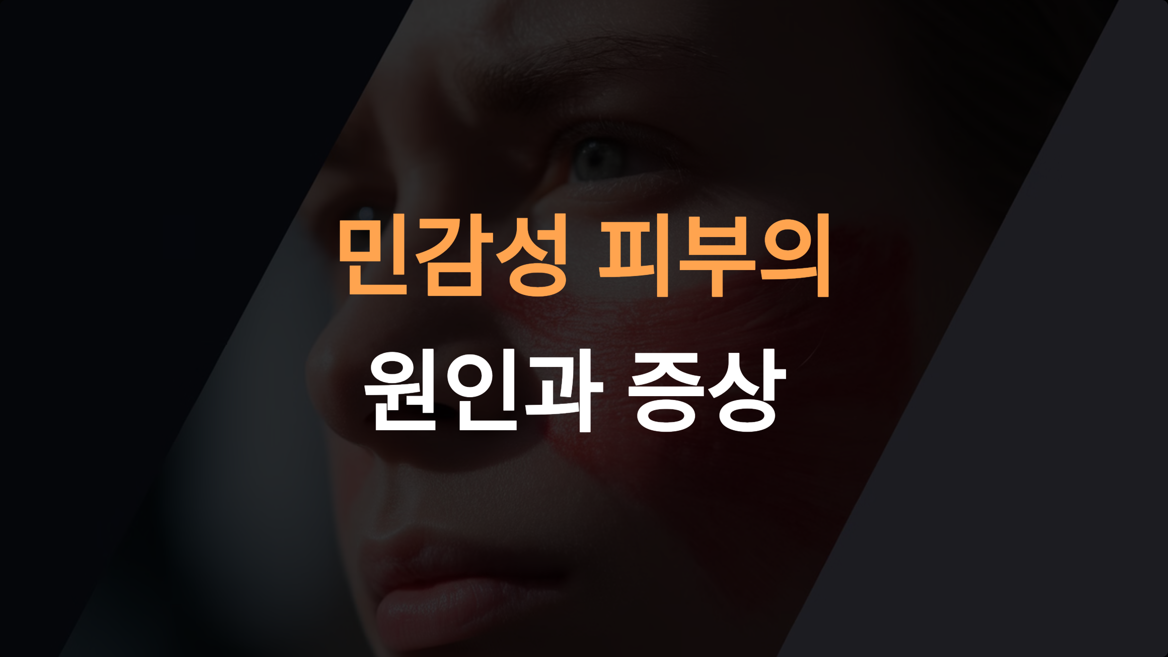 민감성 피부의 원인과 증상: 제대로 이해하고 관리하는 방법