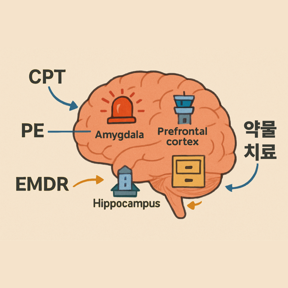 CPT, PE, EMDR, 약물 치료 등 다양한 방법들은 각각 다른 경로를 통해 '과열된 경보기(편도체)'를 진정시키고, '냉철한 통제탑(전전두피질)'의 힘을 되찾아주며, '혼란스러운 기억저장소(해마)'를 정리해주는 인포그래픽