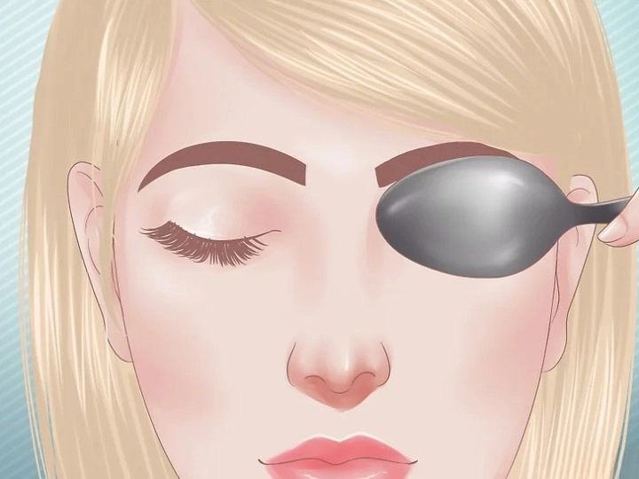 눈이 붓는 이유 붓기 빨리 빼는 방법 눈이 부을때 부었을때 대처방법