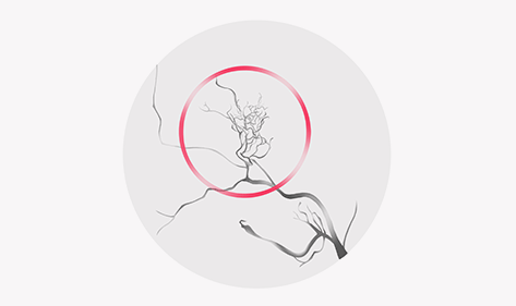 모야모야병, 뇌 혈관의 수수께끼 - 증상부터 치료까지 완벽 가이드