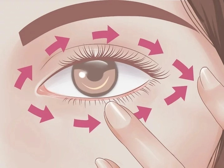 눈이 붓는 이유 붓기 빨리 빼는 방법 눈이 부을때 부었을때 대처방법