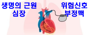 심장-부정맥-사진