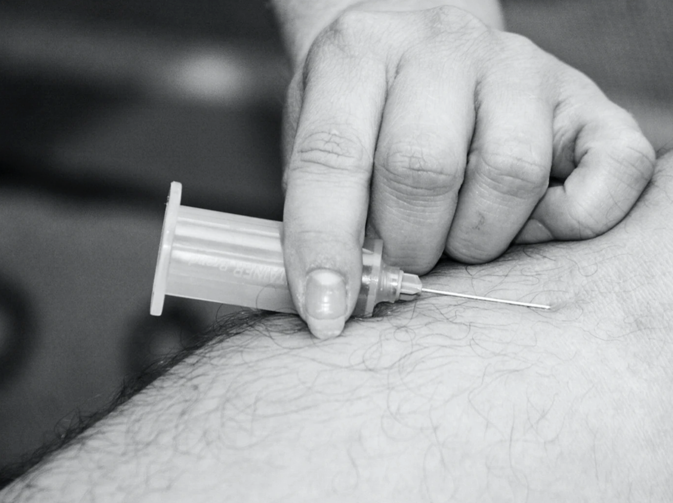 대상포진 예방법 및 치료