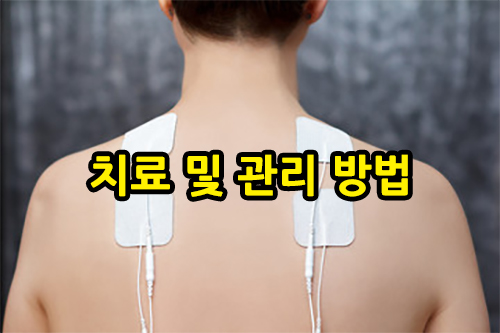 근막통증증후군 치료 및 관리방법