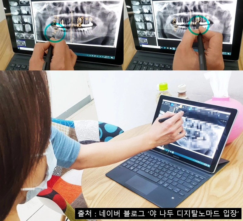 치과-진료-태블릿-활용