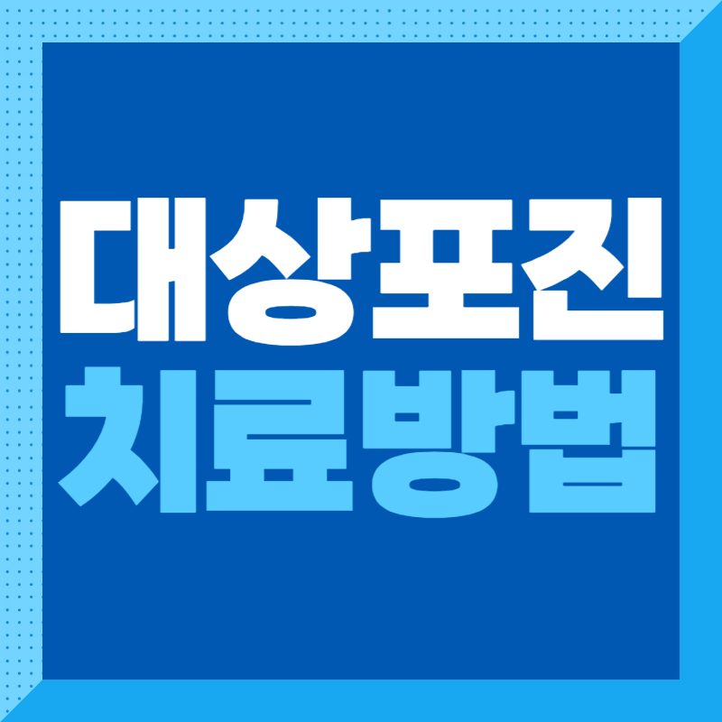 대상포진 치료방법