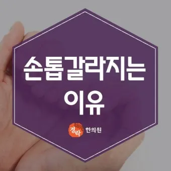손톱이 갈라지는 이유 원인 증상 대처법_18