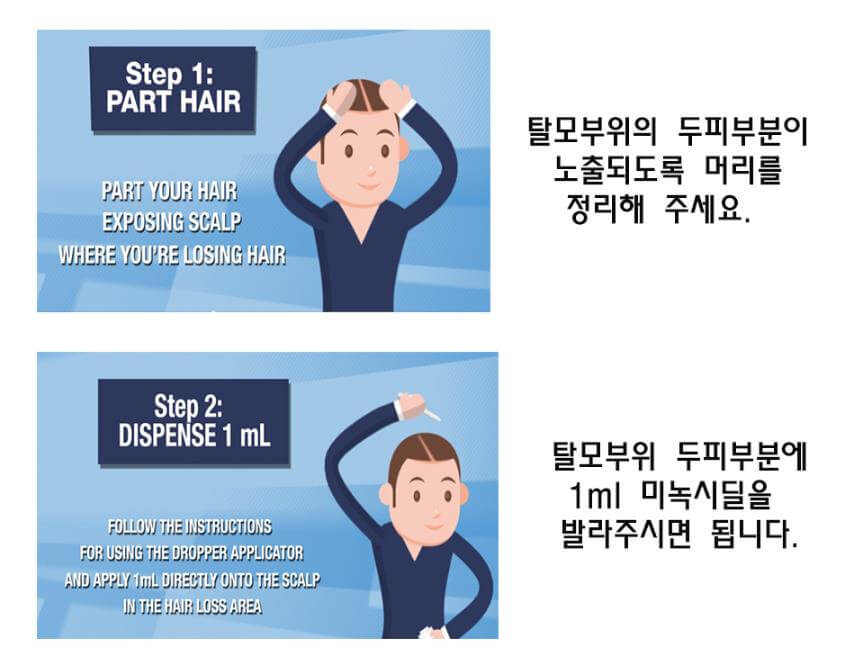 커클랜드 미녹시딜