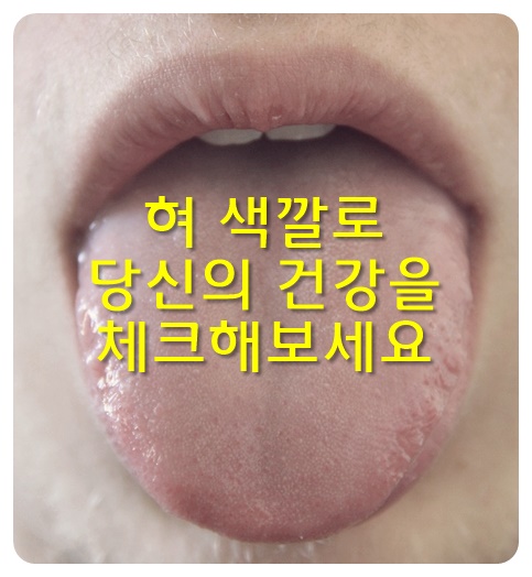 혀 색깔로 당신의 건강을 체크해보세요